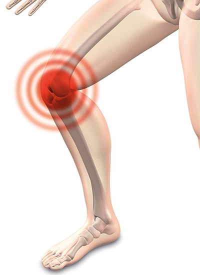 Knee Pain relief Capalaba