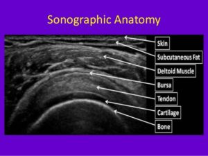 sonographic-anatomy-Capalaba