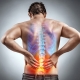 Acute Lower Back Pain Capalaba